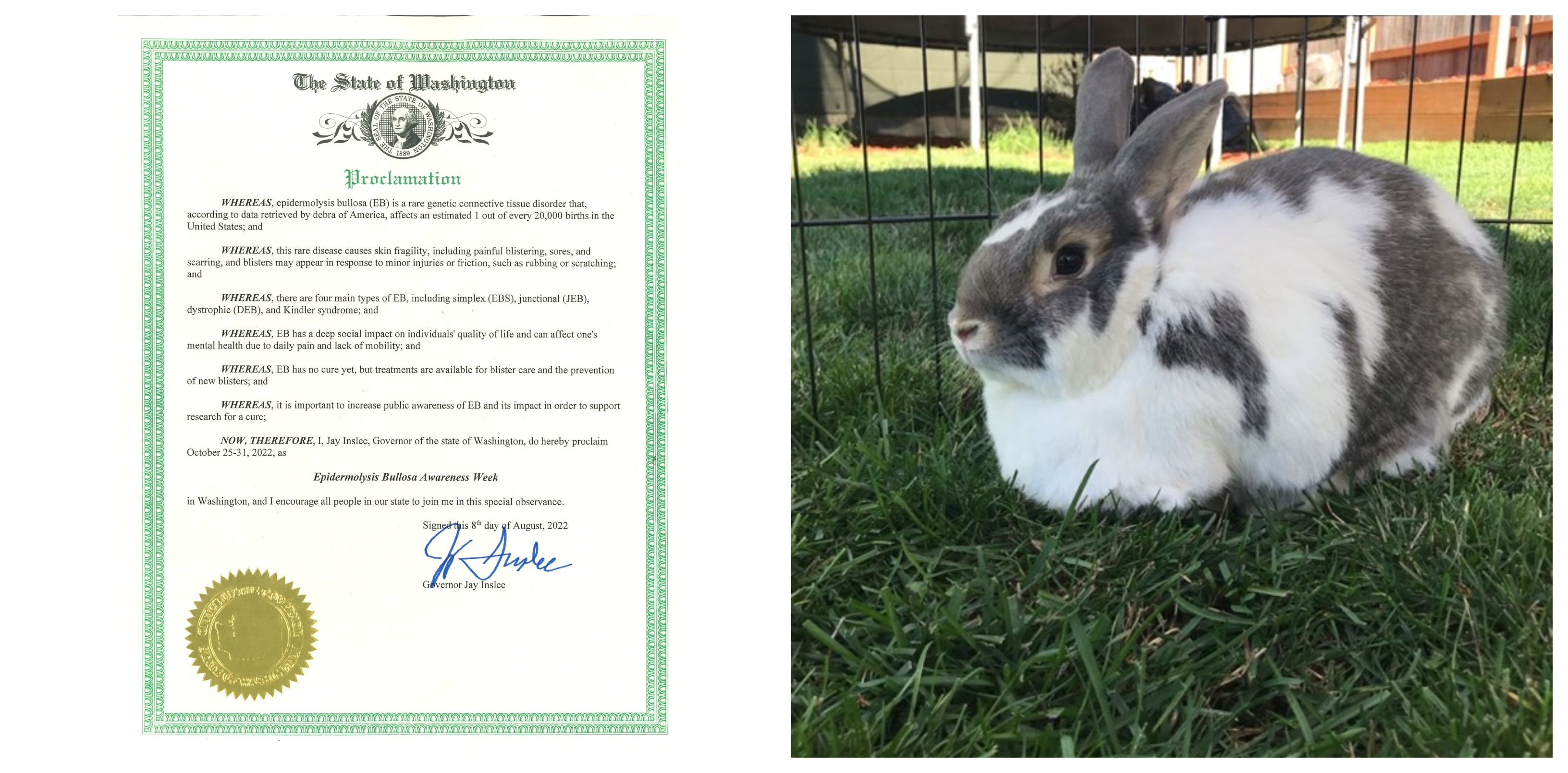 Epidermolysis Bullosa Personal Story