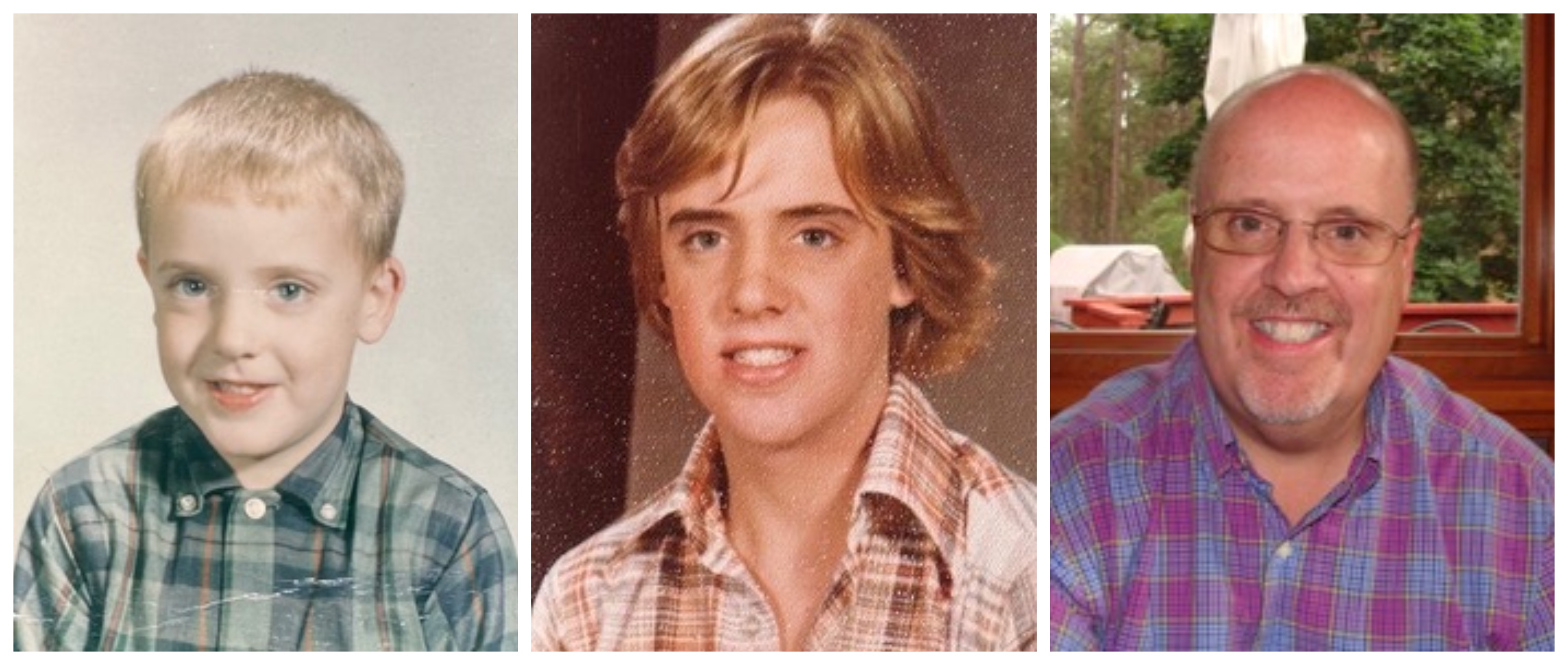 Epidermolysis Bullosa Personal Story